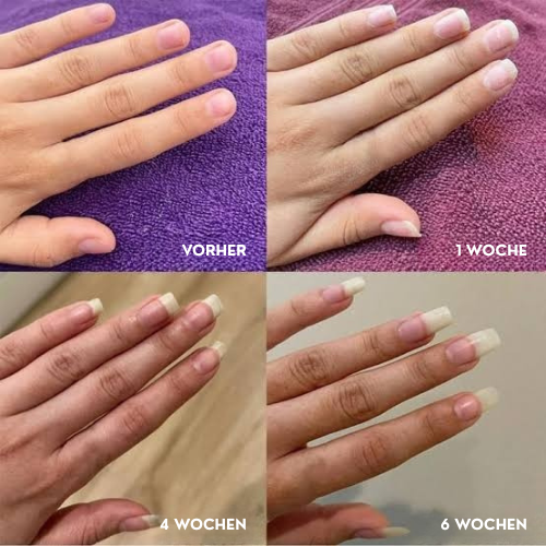 Zanari Nagelwachstums-Öl 3ml