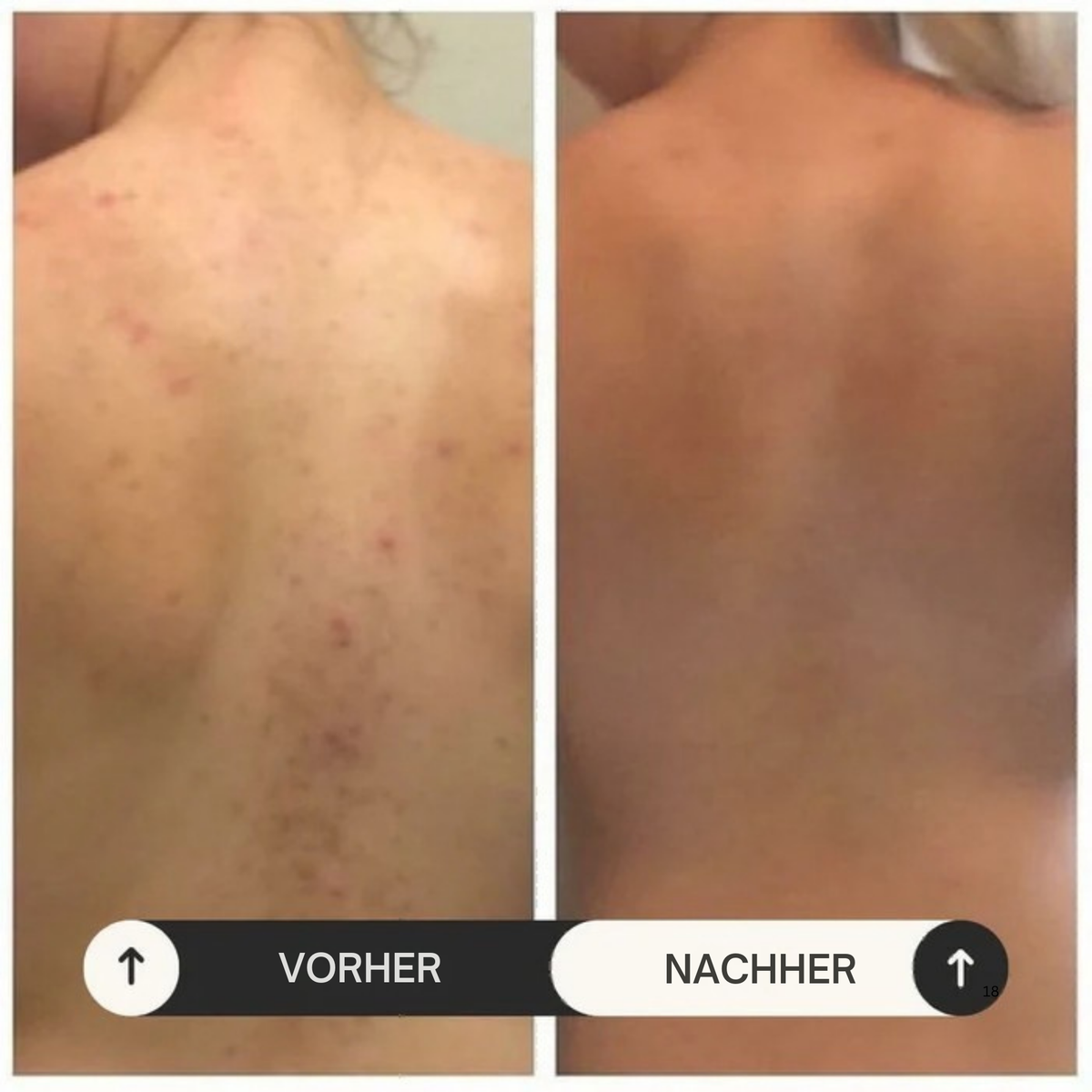 Zanari Peeling-Duschtuch