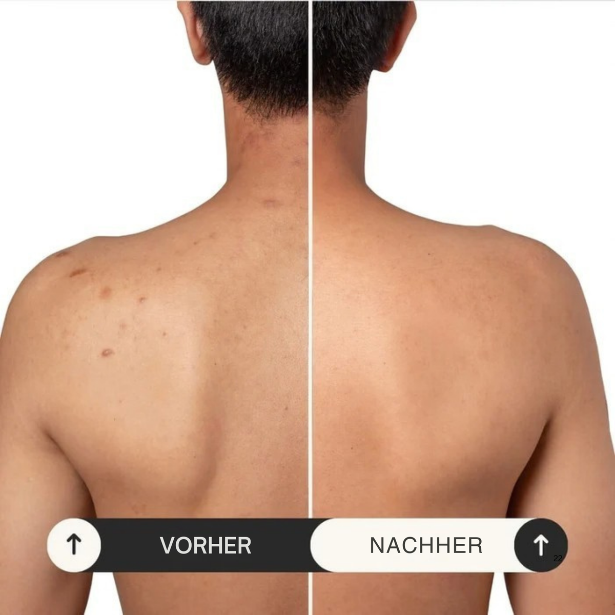 Zanari Peeling-Duschtuch