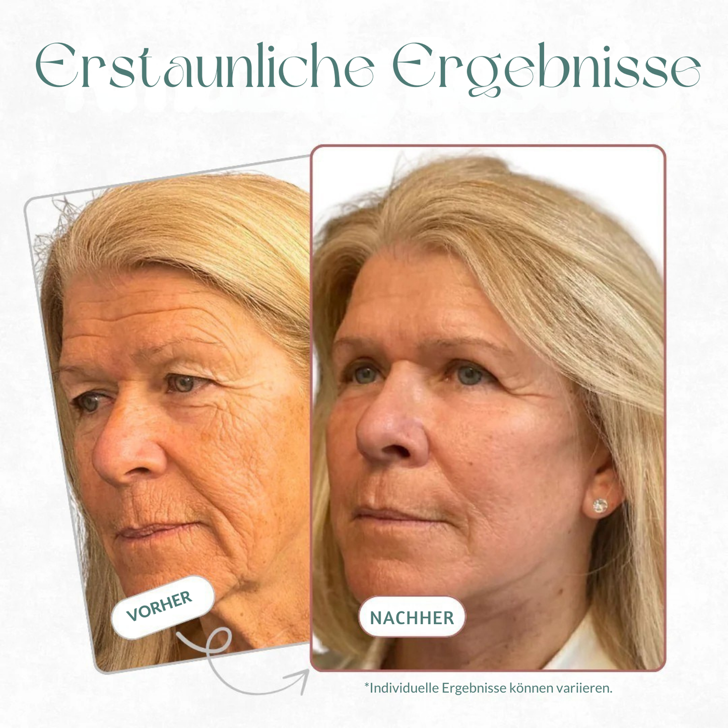 Zanari Kollagen-Stick