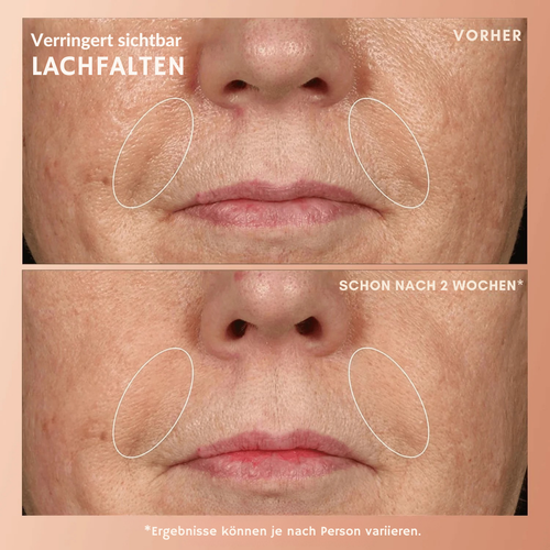 Youth 1700 Anti-Aging Serum