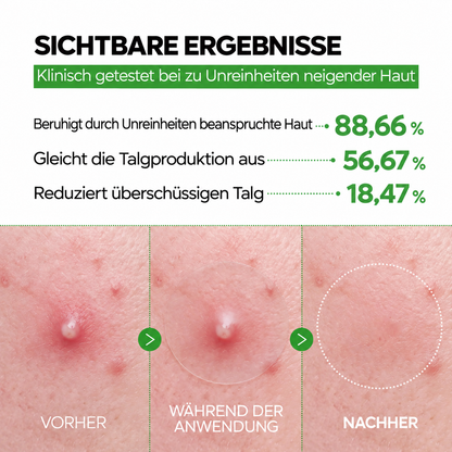 Zanari Unsichtbare Anti-Pickel-Patches mit Zink