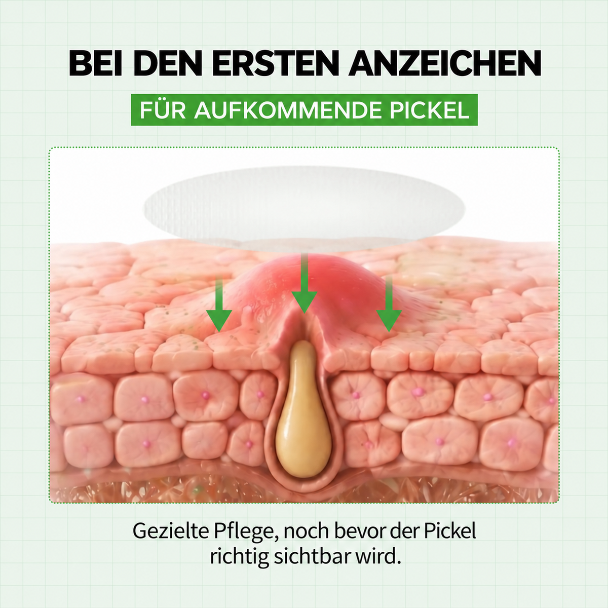 Zanari Unsichtbare Anti-Pickel-Patches mit Zink