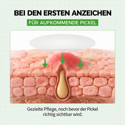 Zanari Unsichtbare Anti-Pickel-Patches mit Zink