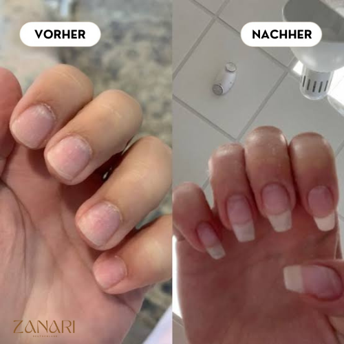 Zanari Nagelwachstums-Öl 3ml