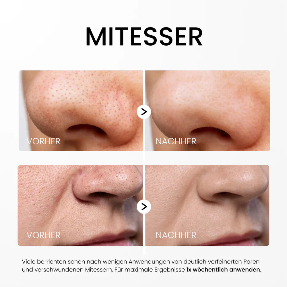 Zanari Reis-Peeling Glow-Serum