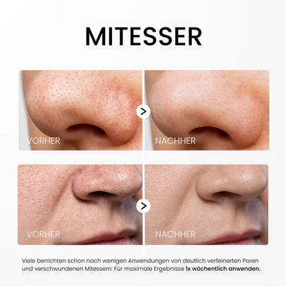 Zanari Reis-Peeling Glow-Serum